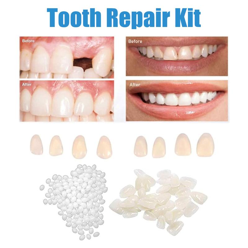 Dental Repair Denture Repair Beads,Tweezers,Dental Pick,Dental Tools for Fixing Filling Missing Broken Tooth Moldable Fake Teeth