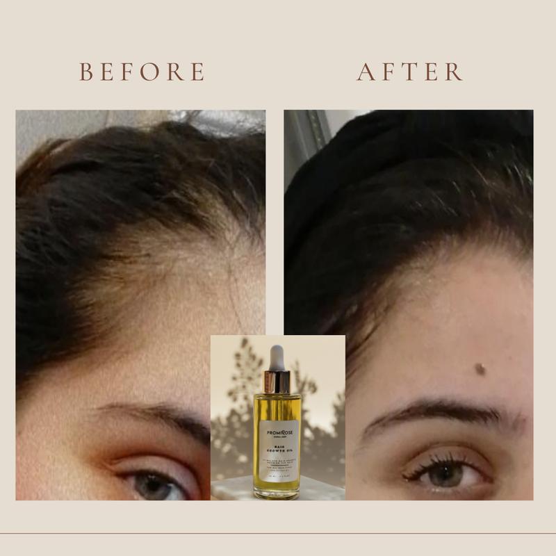 promirose hair Growth oil stimulates hair growth