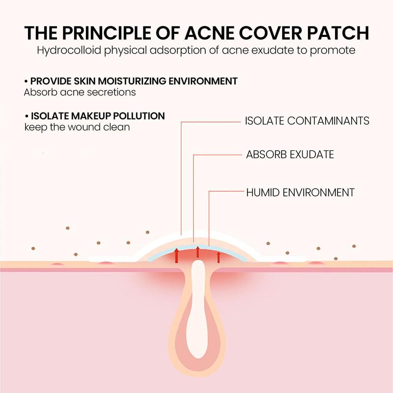 Star Shaped Acne Patch,  Facial Care Pads for Covers Blemishes, Zits, Spots, Pimples, Professional Skin Care Product for Women & Men