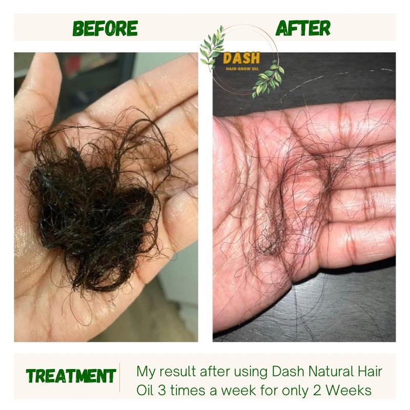 Dash Natural Hair Grow Oil, Hair Growth product, Rosemary Oil for Hair Growth, Follicles Strengthening Oil, Nourishing Treatment for Split Ends, For All Hair Type Silicone Free, Hair Nutrition, Hair Growth, Haircare,Jojoba Olive Peppermint Comfort