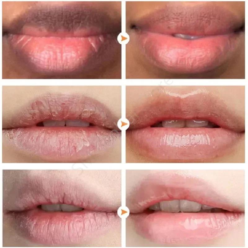 Herbal Lip Cream Cold Sores Treatment Lip Repair Anti Lip Wrinkles Anti-dry Cracking Exfoliating Scrub Moisturizing Lip Oil Balm honey lip