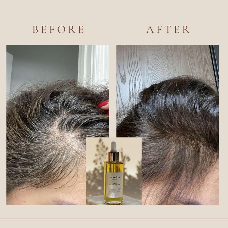 promirose hair Growth oil stimulates hair growth