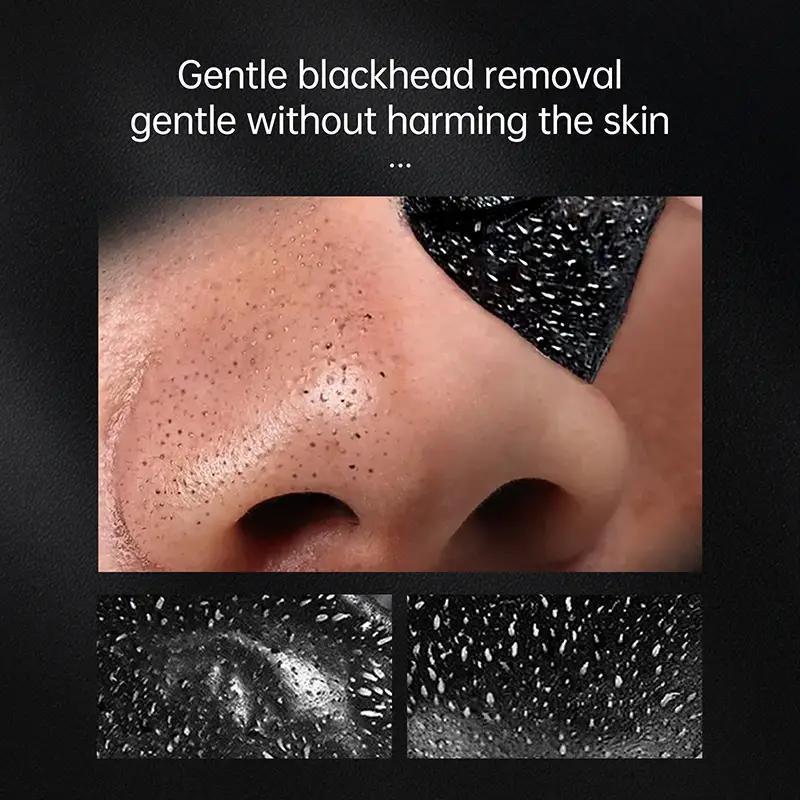 Acne removing facial mask, deep cleaning of facial acne, nose, pores, and acne, suitable for all skin types