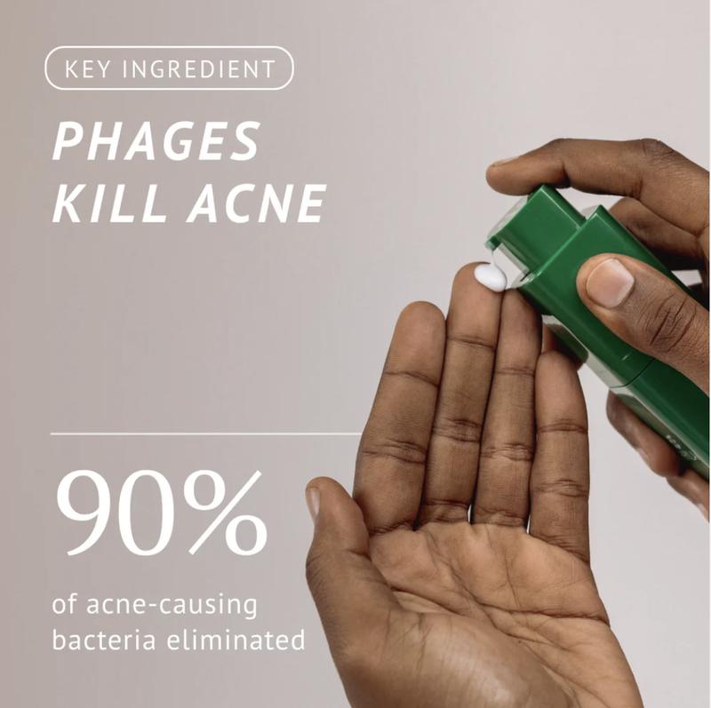 Acne-Fighting Phage System - 60 Day Supply