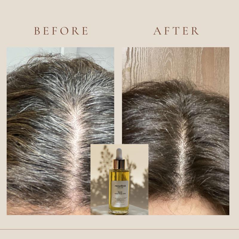 promirose hair Growth oil stimulates hair growth