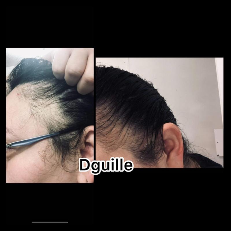 Shampoo. Rosemary.  doña guille Rosemary Haircare hairloss alopecia