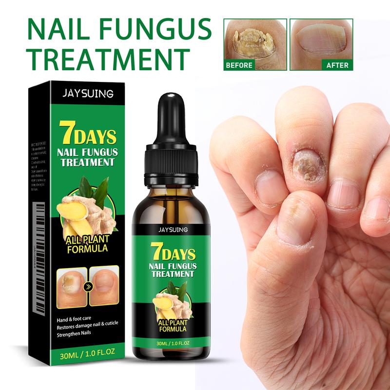 GIngersor  Trestmet  Support  Care  fungus prevention ginger nail serum Organic Nail Organic Nail nail essence