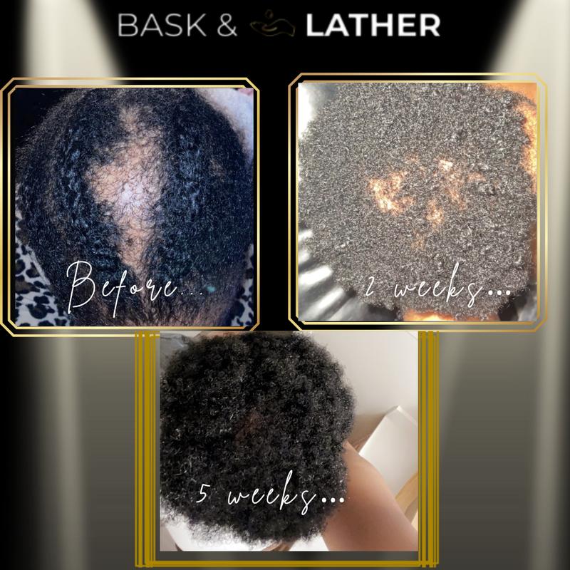 Scalp Stimulator | Hair Growth Oil Haircare Lightweight growth thin stimulate growth