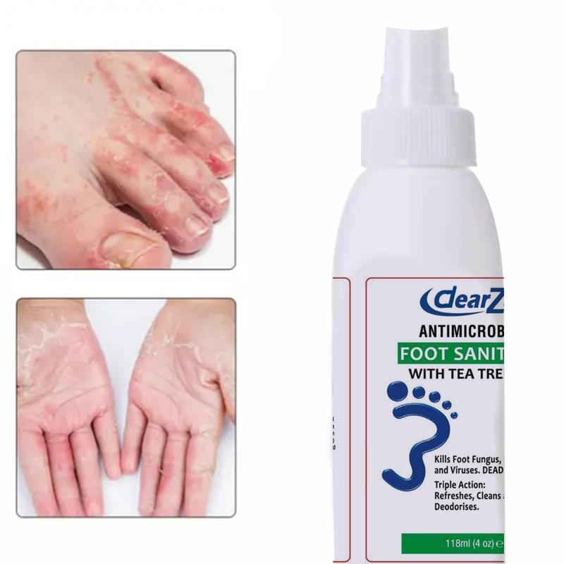 dearZal Tea Tree Oil Soaked Foot Disinfectant Spray, plant extracts effectively remove odor and improve foot fungus growth