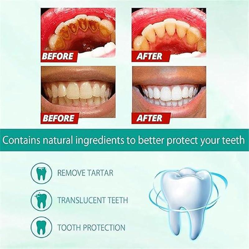 [90% People Choose] 2PCS SP-6 Toothpaste Oral Health Management, Fresh Breath