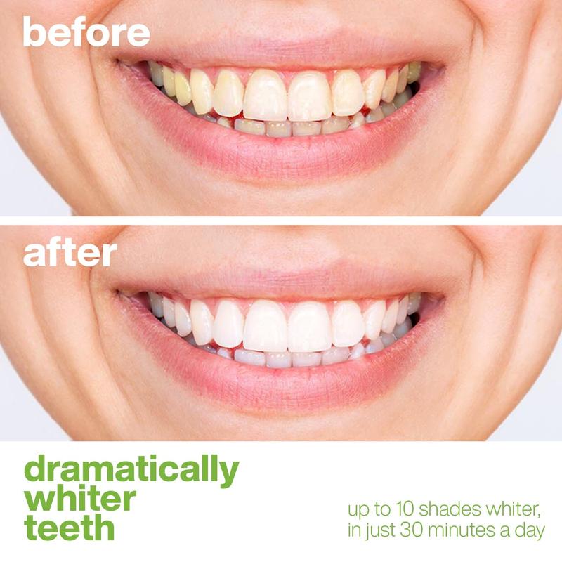 Professional Teeth Whitening Strips