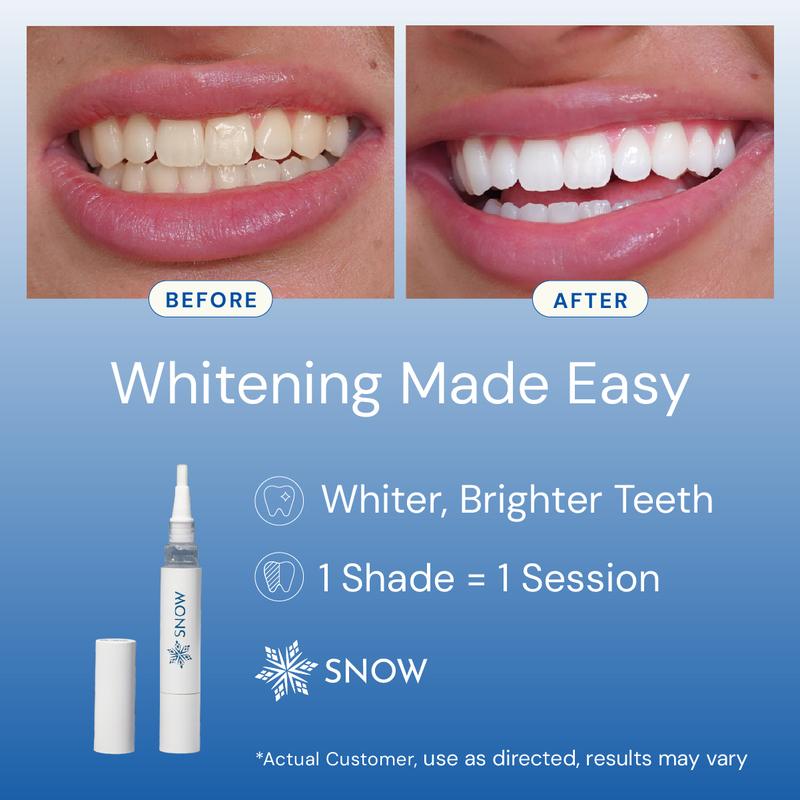 SNOW Diamond Teeth Whitening Wand | Strengthens Your Teeth by Repairing and rebuilding Enamel While You Whiten | Safe & Gentle on Enamel