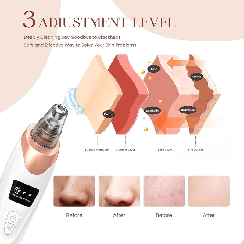 Blackhead Remover Pore Vacuum Kit - Upgraded Blackhead Extractor Tool with 3 Adjustable Suction Levels, 5 Probes, USB Rechargeable, Suitable for Women and Men