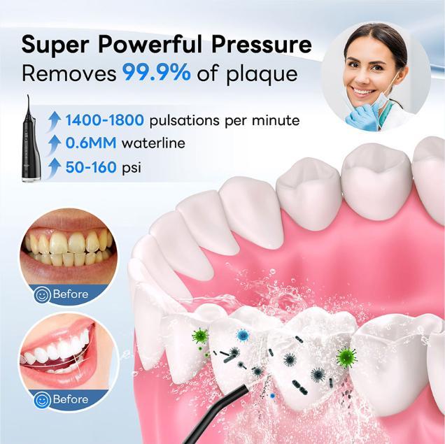 4-in-1 Water Flosser for Teeth - 310ML Capacity Upgrade, Rechargeable & IPX7 Waterproof for Ultimate Oral Hygiene